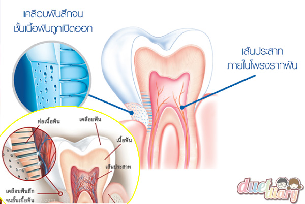 เสียวฟัน,แก้เสียวฟัน,รักษาเสียวฟัน,ปัญหาเสียวฟัน,ยาสีฟันแก้เสียวฟัน,ยาสีฟัน,sensodyne