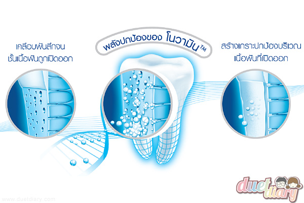 เสียวฟัน,แก้เสียวฟัน,รักษาเสียวฟัน,ปัญหาเสียวฟัน,ยาสีฟันแก้เสียวฟัน,ยาสีฟัน,sensodyne